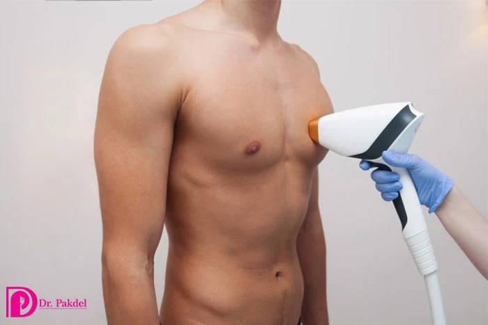 The best laser hair removal device