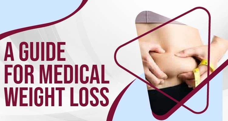 A Guide for Medical Weight Loss