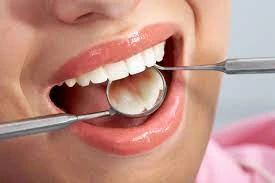 ما هو علاج زراعة الاسنان
