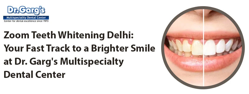 Zoom Teeth Whitening Delhi: Your Fast Track to a Brighter Smile at Dr. Garg’s Multispecialty Dental Center