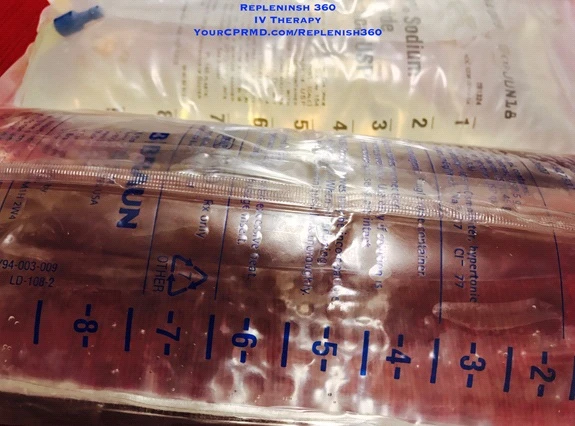 IV Hydration Therapy Imparts Nutrients and Improves Health of Humans