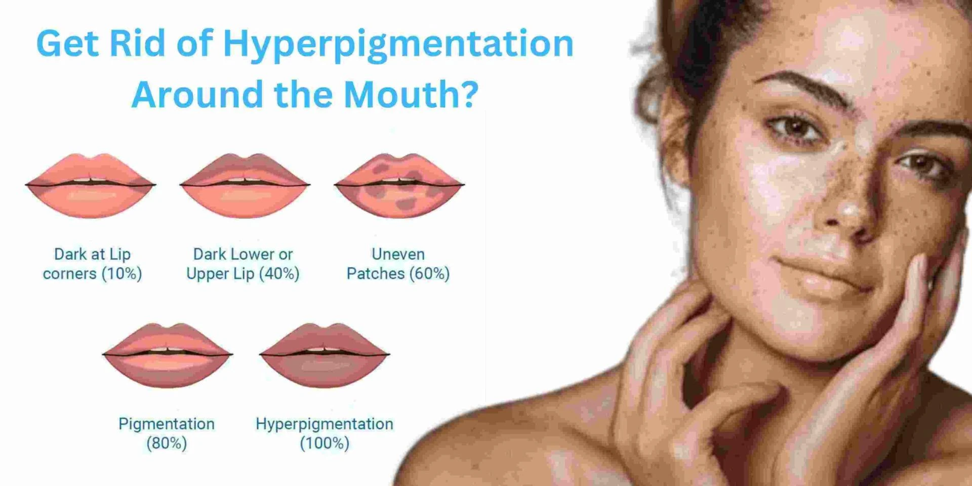 How Do You Get Rid of Hyperpigmentation Around the Mouth?