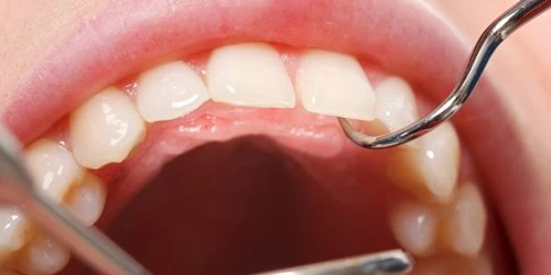 How are Dental Services in Three Rivers so much helpful?