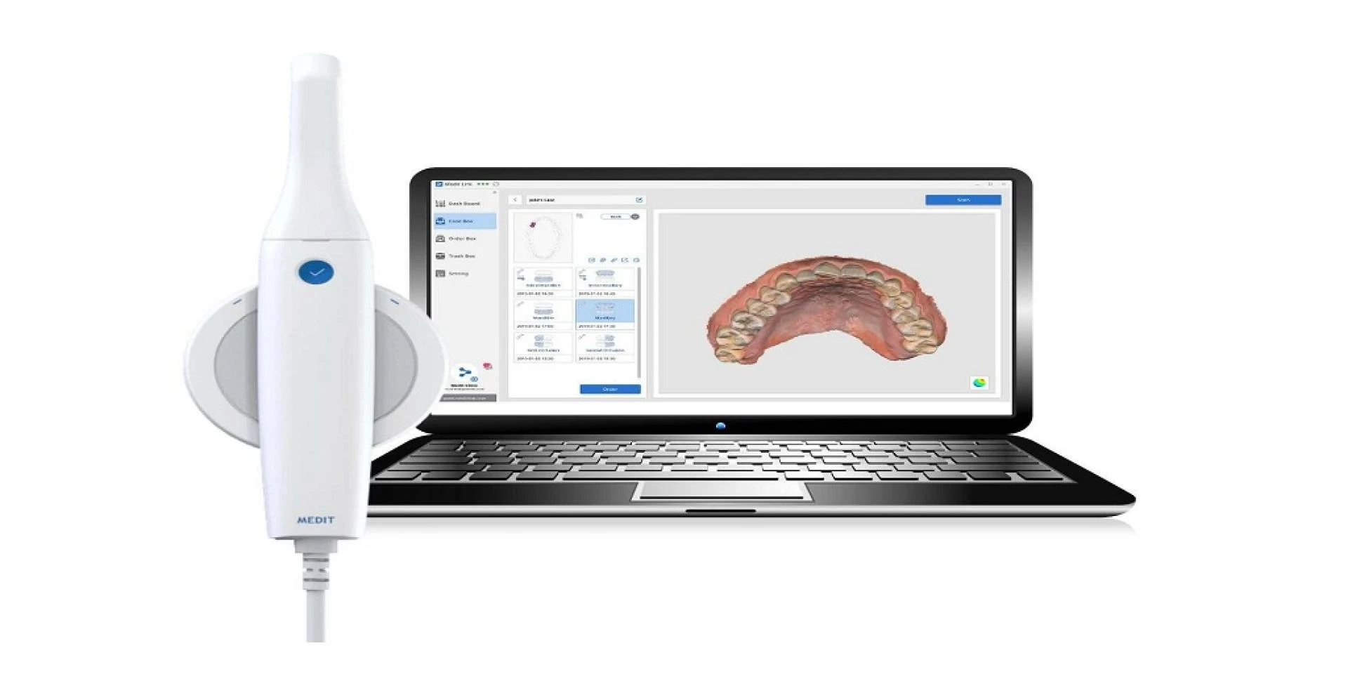 Intraoral Scanner Review: Medit Scanners