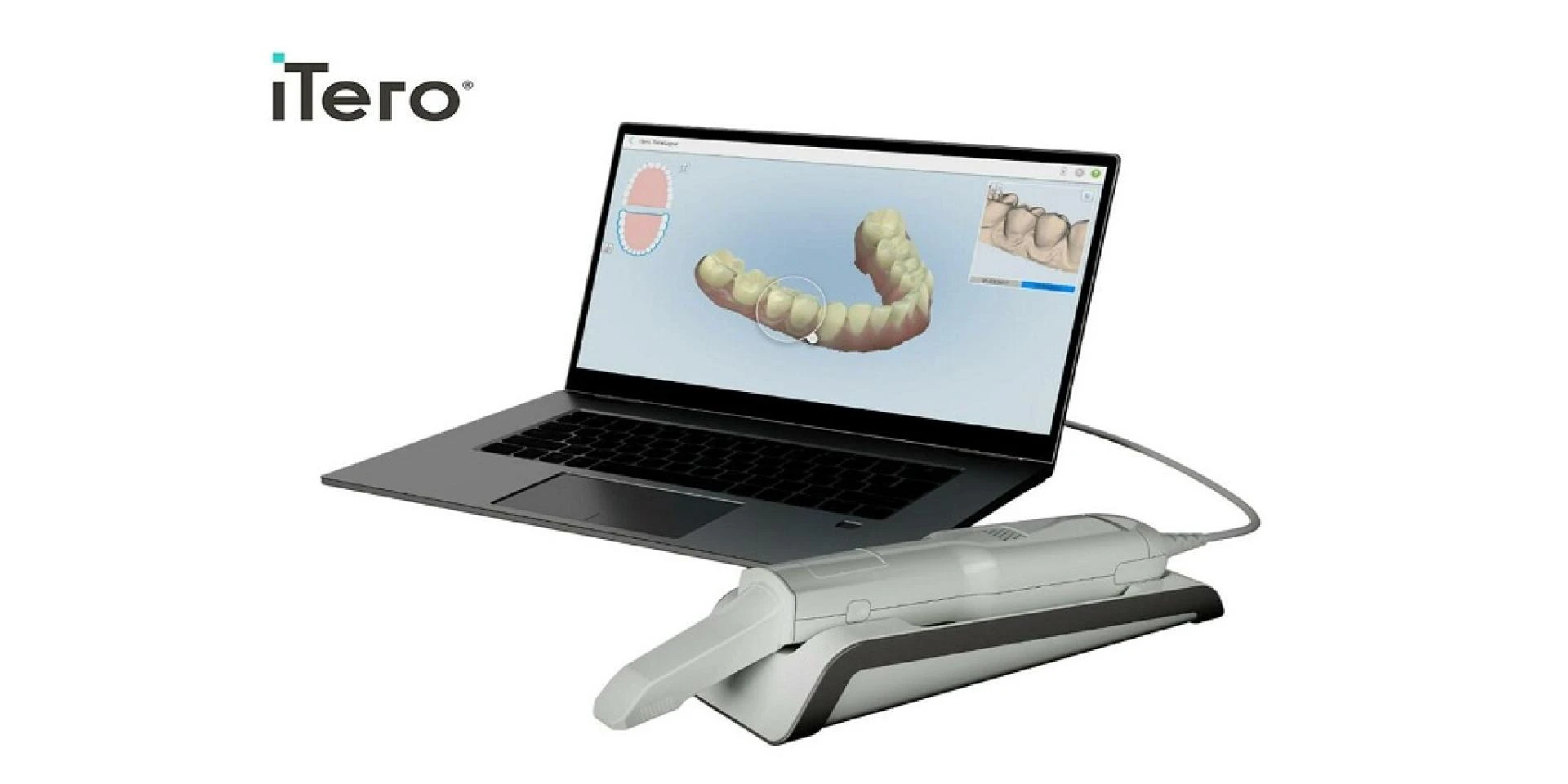 Why Does My Dental Practice Need an Intraoral Scanner?