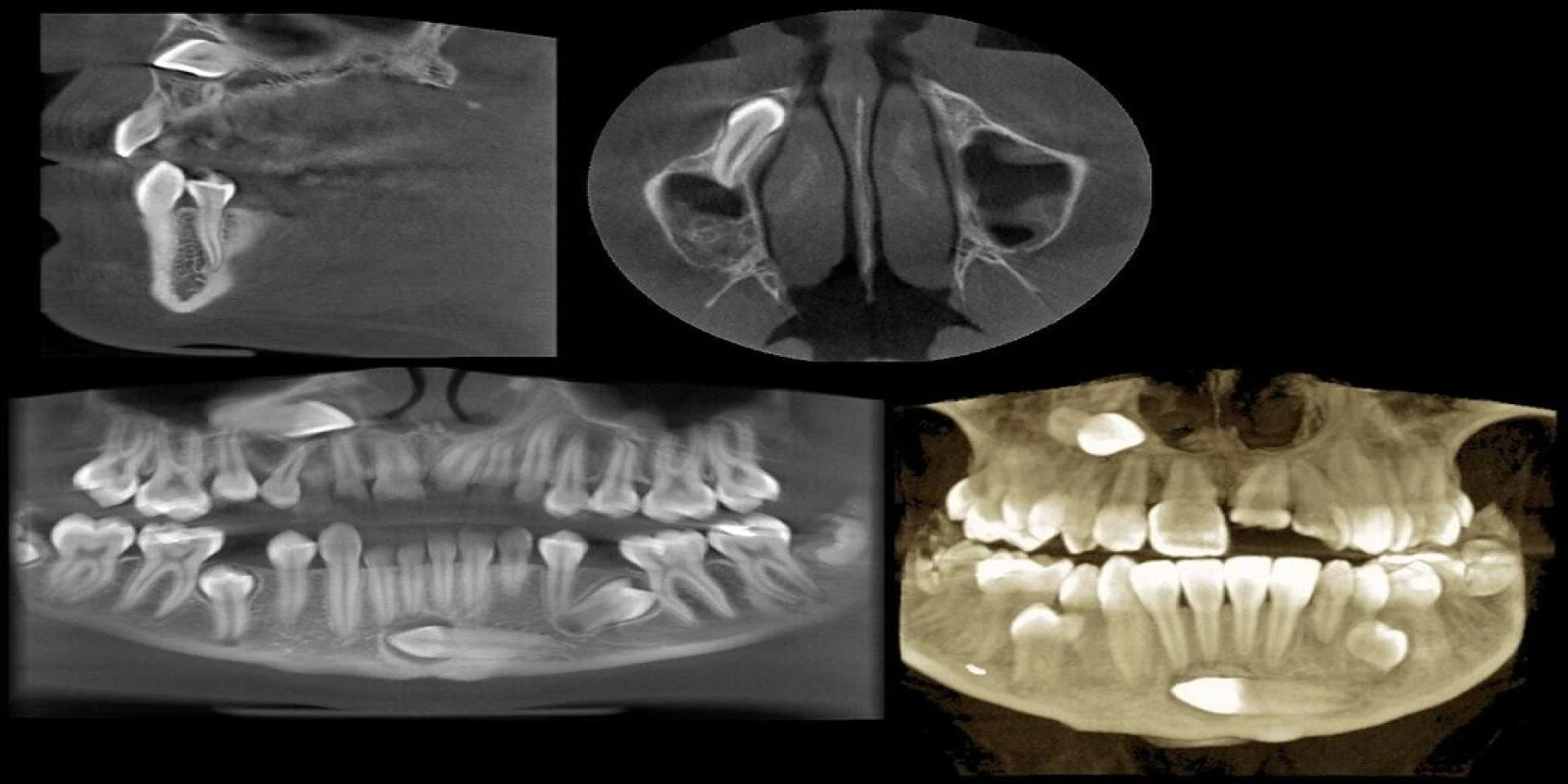 Why the Planmeca ProMax 3D Mid Is a Good Fit for Your Practice