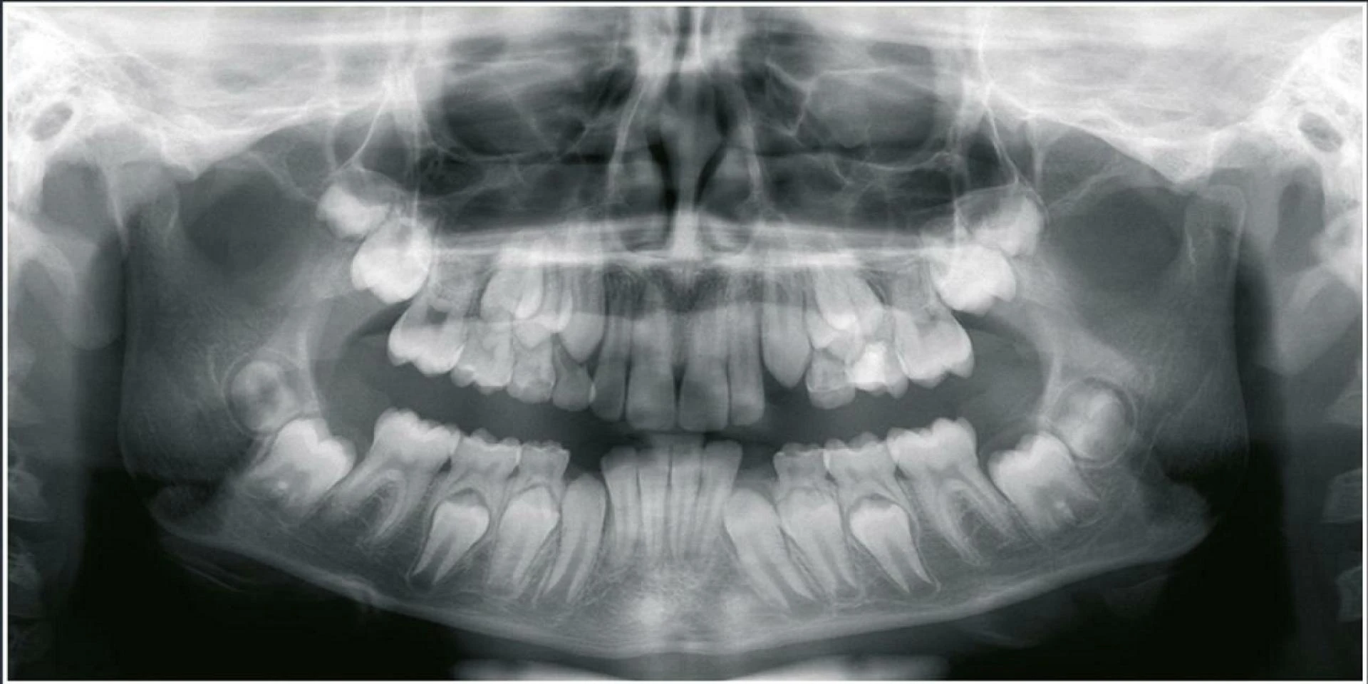 Panoramic X-Ray Machines: Applications, Types &amp; Cost