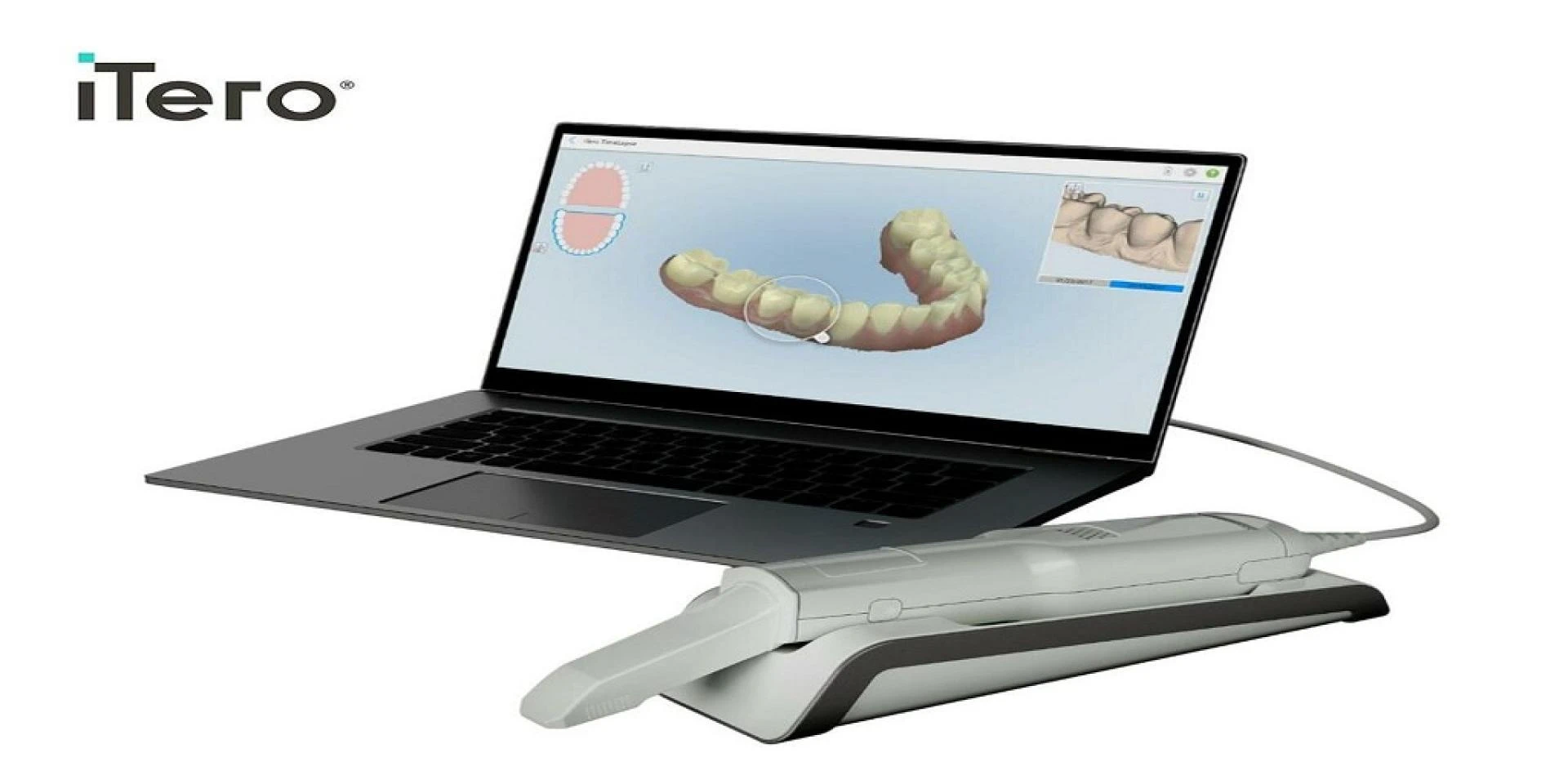 Dental Scanners: A Brief History and Emerging Trends