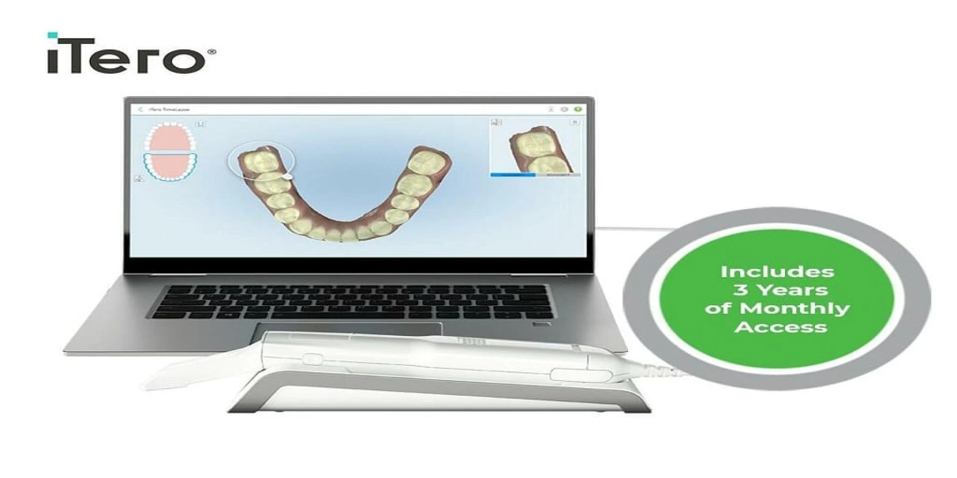 Dental Professionals Guide to Intraoral Scanners
