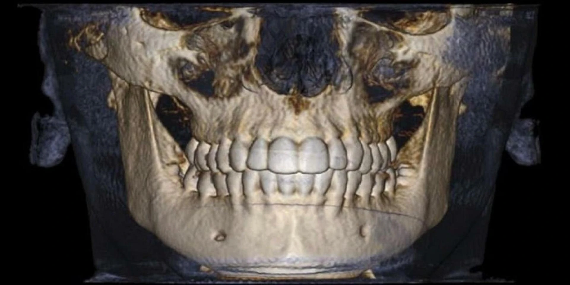 i-CAT CBCT Software Review: Tx STUDIO