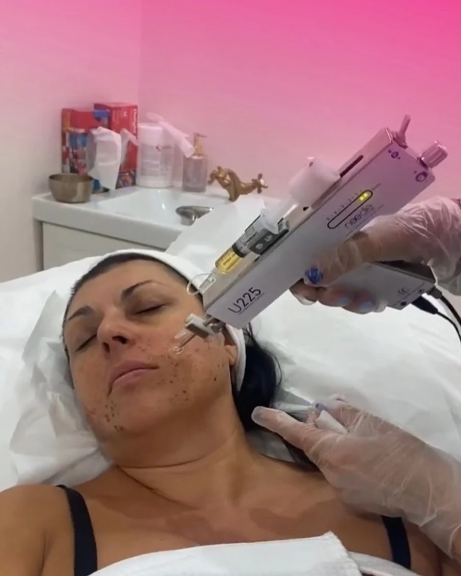 Enhancing Your Beauty at The Glam Room: A Dive into Belkyra and Wrinkle Reduction Injections in Toronto