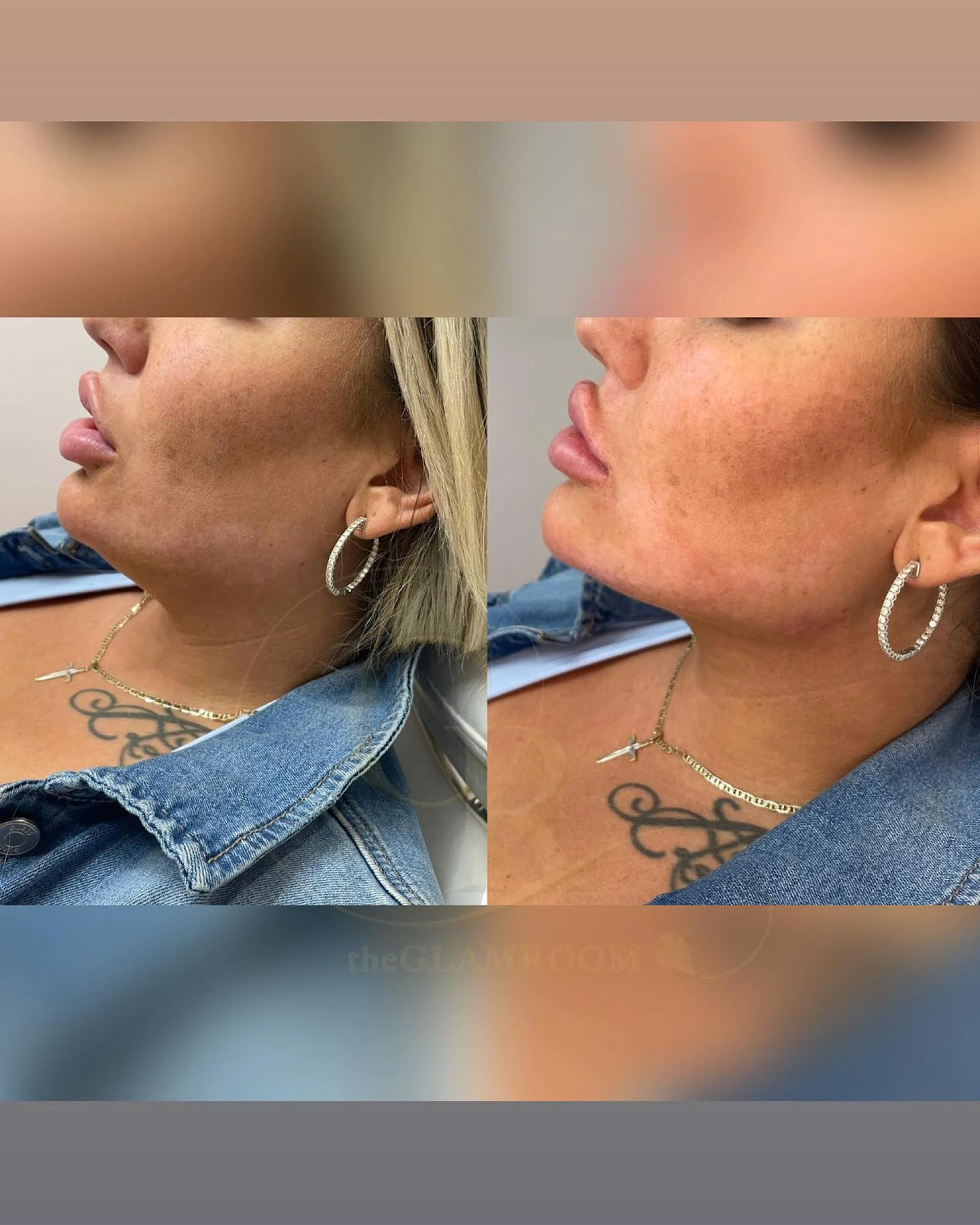 Achieve Your Best Look With PDO Threads Toronto