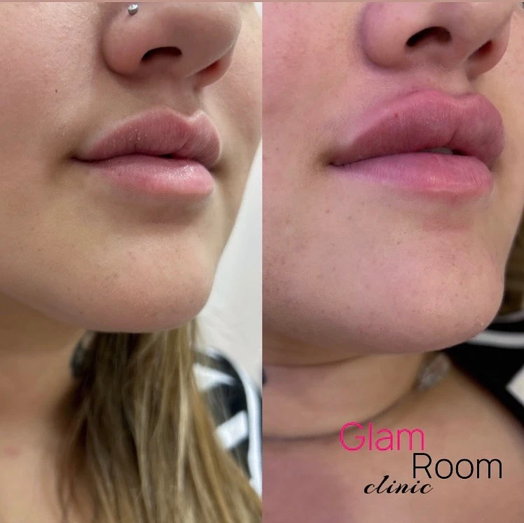 The Glam Room: Your One-Stop Destination for Rejuvenation and Confidence