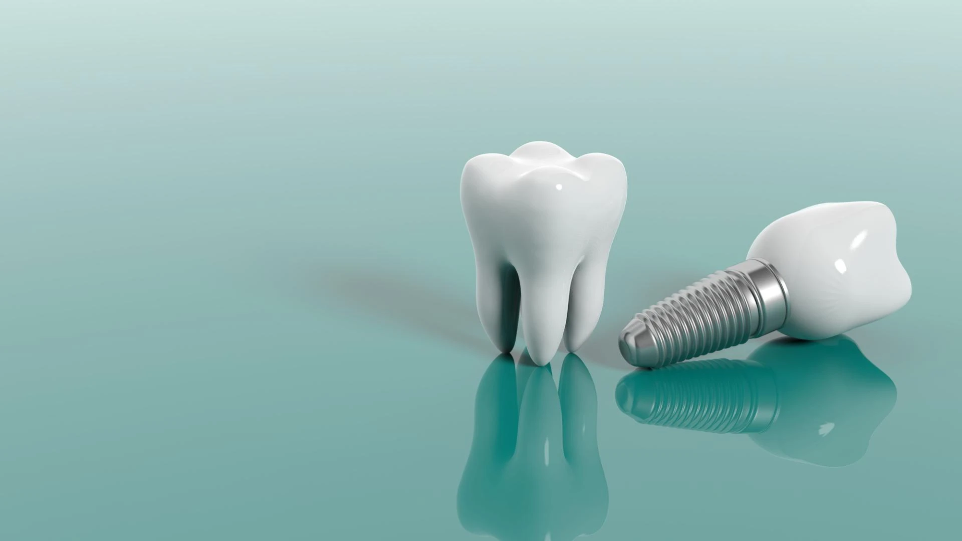 What are the Factors Depending on the Cost of Dental Implants?