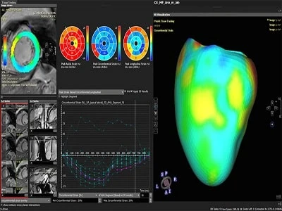 India Cardiac Medical Imaging Software Market to Establish Growth with Higher Investments Until FY2027 | TechSci Research