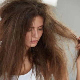 How to Fix Winter’s 5 Worst Hair Problems