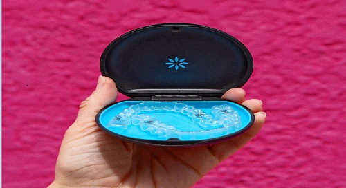 What is Invisalign? 7 Amazing Benefits of Invisalign