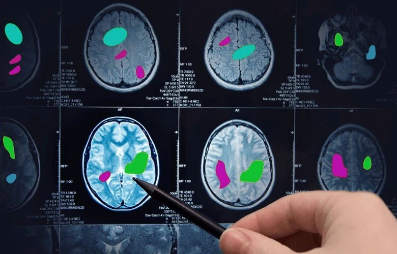 AI in Healthcare: Trends and Applications