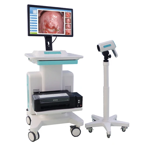 Colposcope Medical Imaging Method Is Used In Coloposcopy to Determine Whether a Woman Has Cervical C