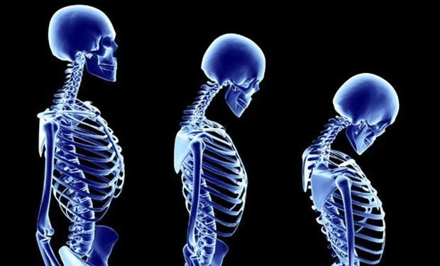 Ageing &amp; Bone Diseases