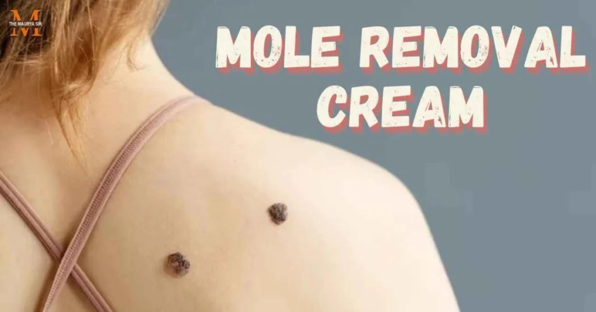How to Choose the Best Mole Removal Cream