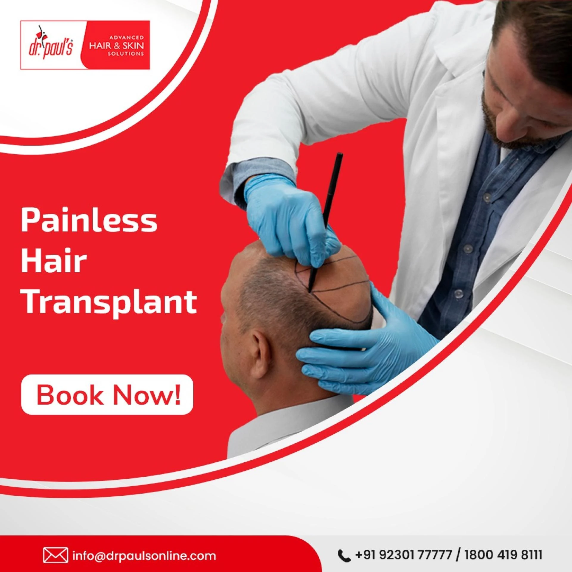 PDO Hair Regrowth Treatment- Is It Worth?