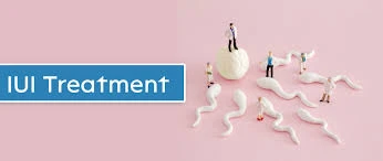 How to Choose the Right IUI Doctor in Sarjapur Road