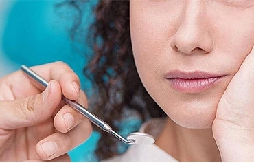 Are Dental Implants the Right Solution for Your Missing Teeth?