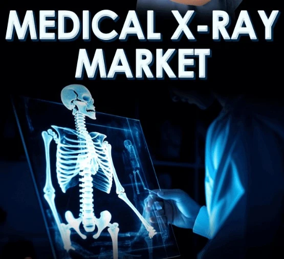 Medical X-ray Market Size, Global Industry Growth, Forecast to 2030