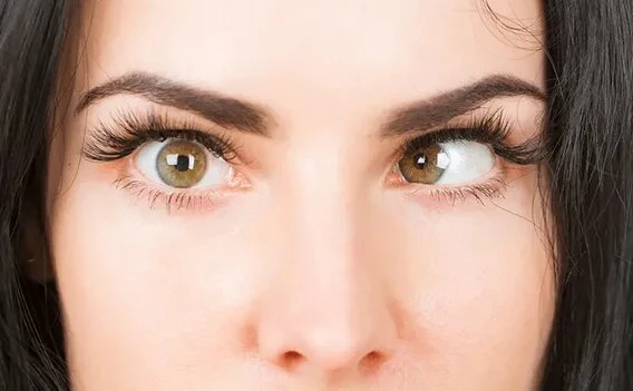 Best Squint Eye Specialist in Bharti Eye Foundation: