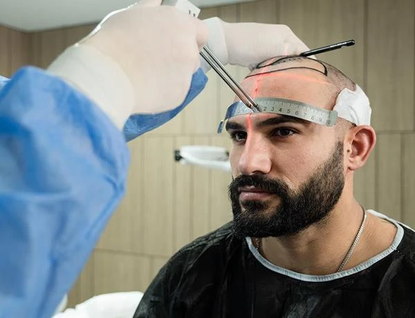 إحياء الجذور: الكشف عن أسرار زراعة الشعر
