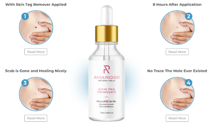 Amarose Skin Tag Remover Review - Know Why People Getting Crazy For It! Price
