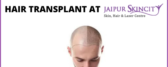 “Jaipur Skincity” Best Hair Fall Treatment Center in Jaipur