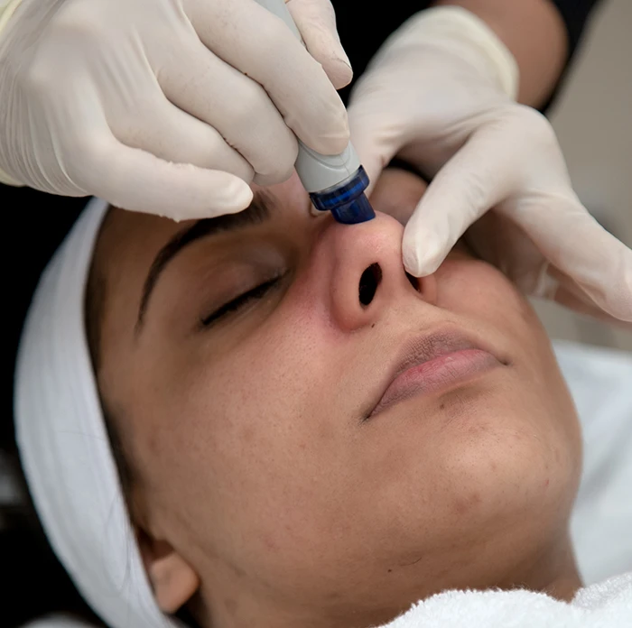 Get Anti Ageing Contouring Treatment
