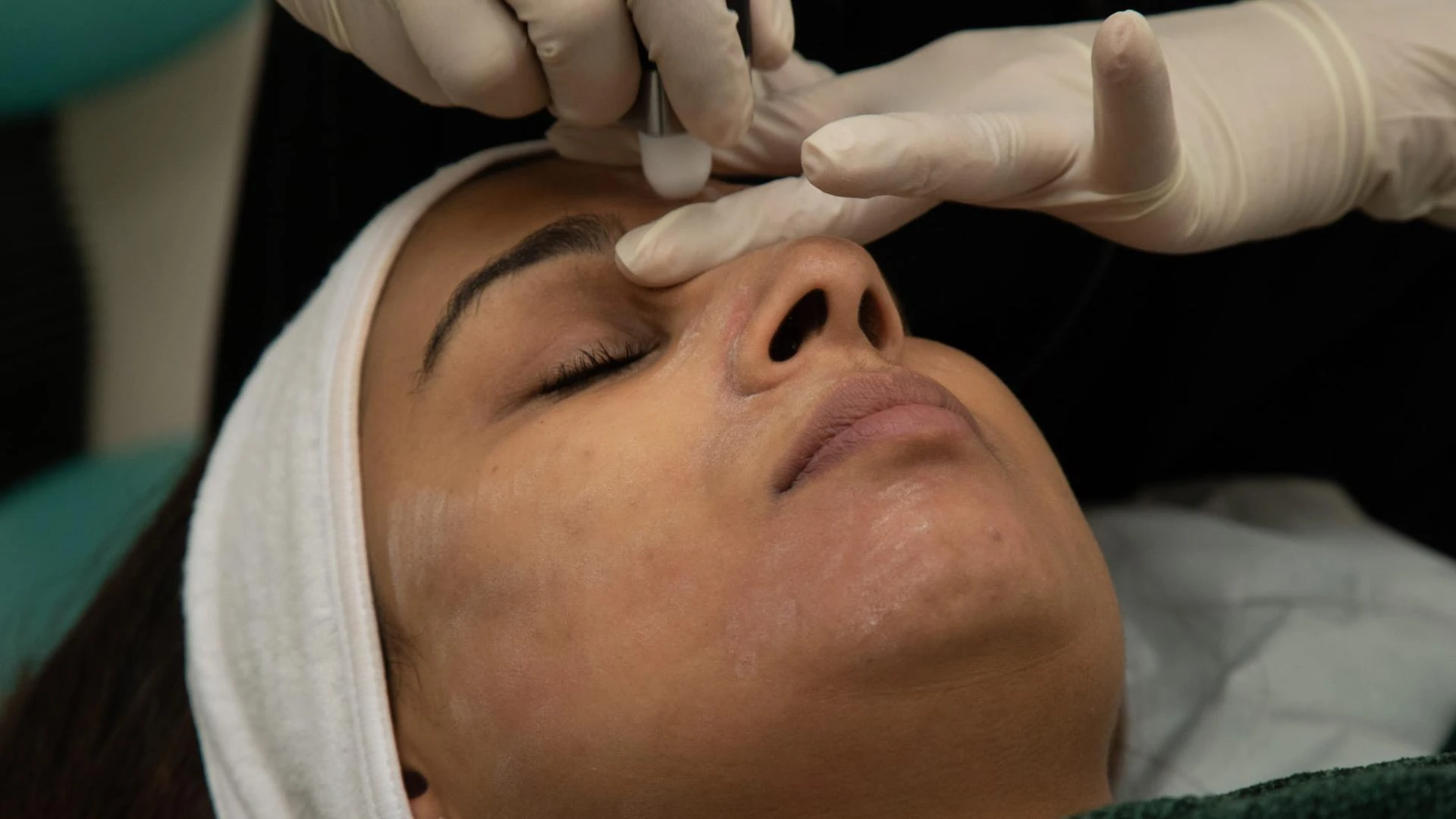 Best Skin Rejuvenation Treatment