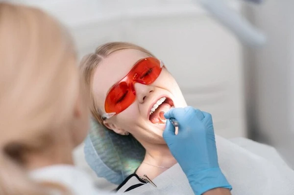 Teeth Whitening: The Basics, Benefits, and Options