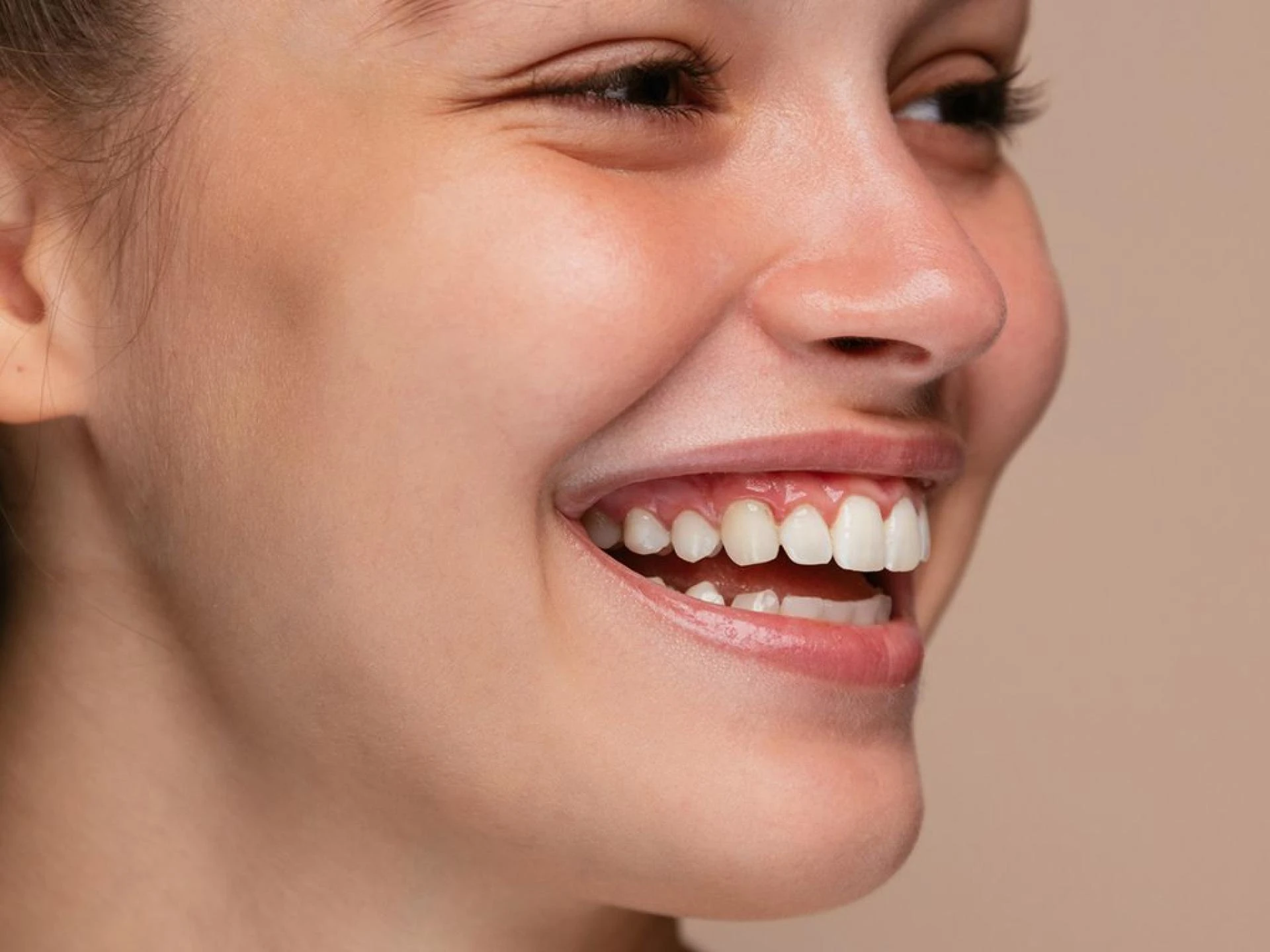 How Composite Bonding Can Correct Teeth Discoloration and Stains