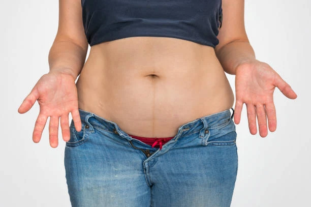 Endoscopic weight loss balloon in Riyadh (5)