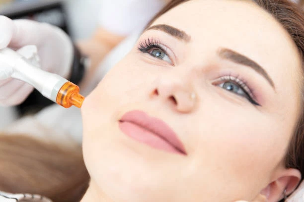 Eye lift with a laser in Riyadh (19)