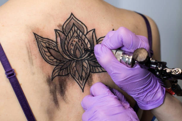 Tattoo removal paper in Riyadh (8)
