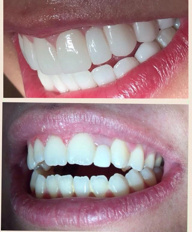 corrective jaw surgery in delhi