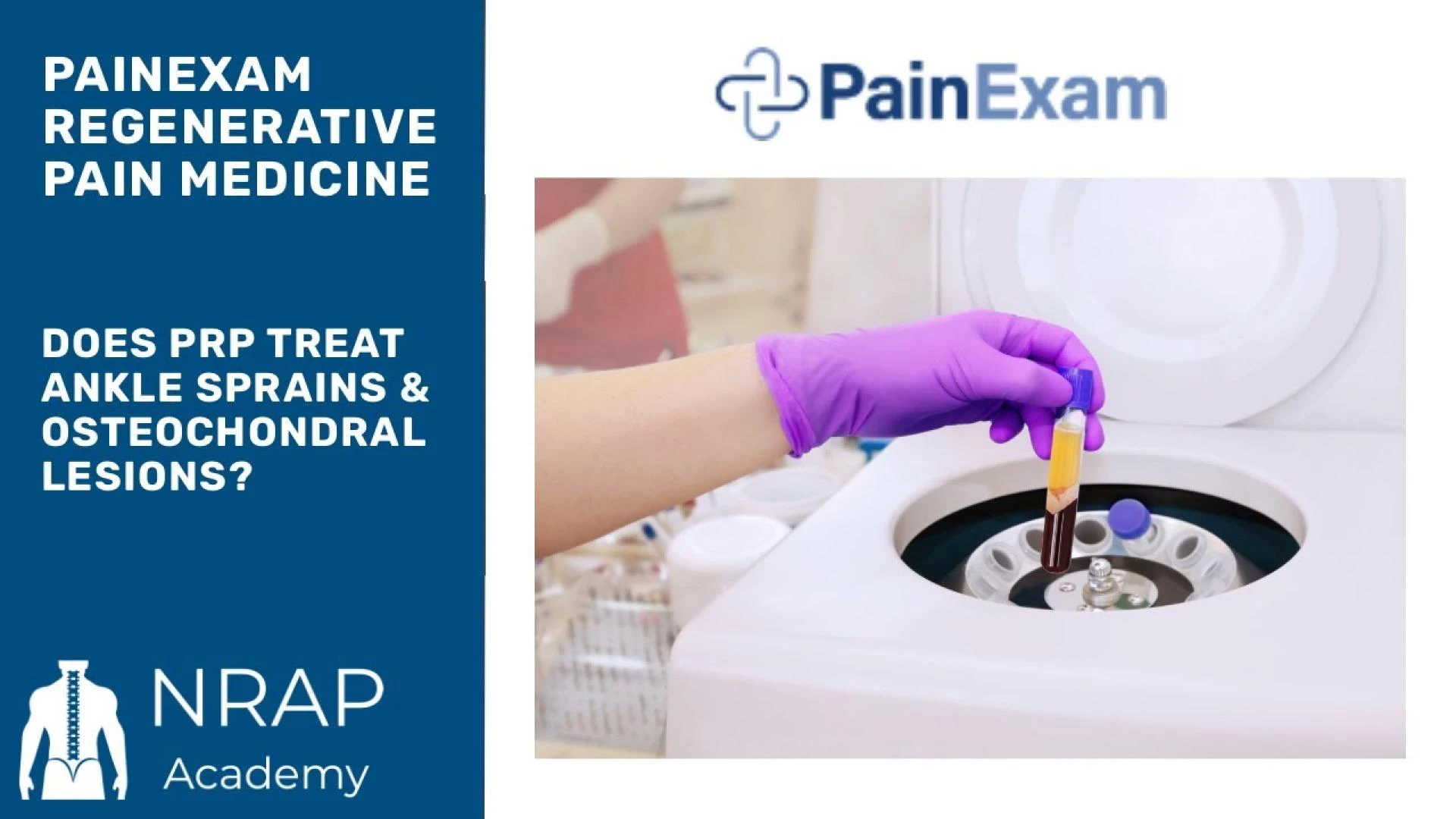 Does PRP treat Ankle Sprains & Osteochondral Lesions? Dr Rosenblum\'s, Regenerative Pain Course