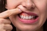 The Connection Between Bleeding Gums and Overall Health