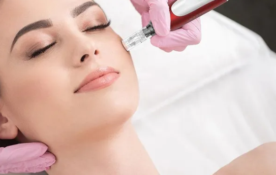 Discover the Transformative Power of Microneedling