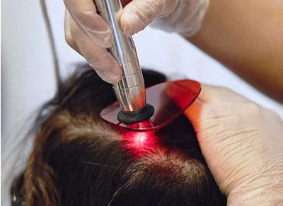 laser hair removal in Malleshwaram