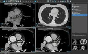 Revolutionizing Diagnostics: How CT Scan Viewers Enhance Medical Imaging