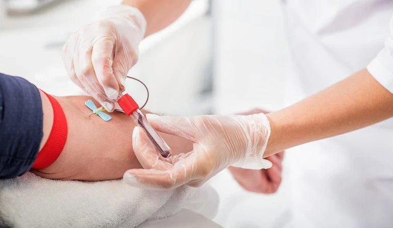 Blood Test at Home: Convenient and Stress-Free Healthcare