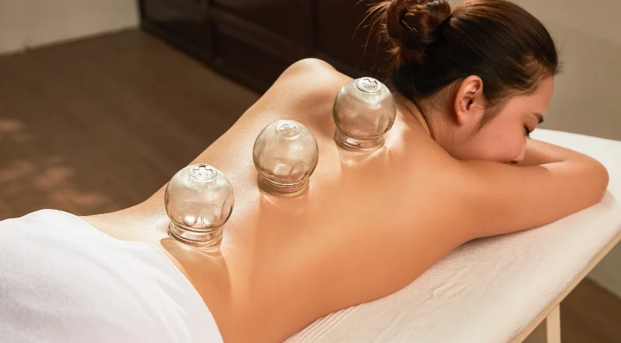 The Healing Power of Cupping Therapy at Miami Acupuncture