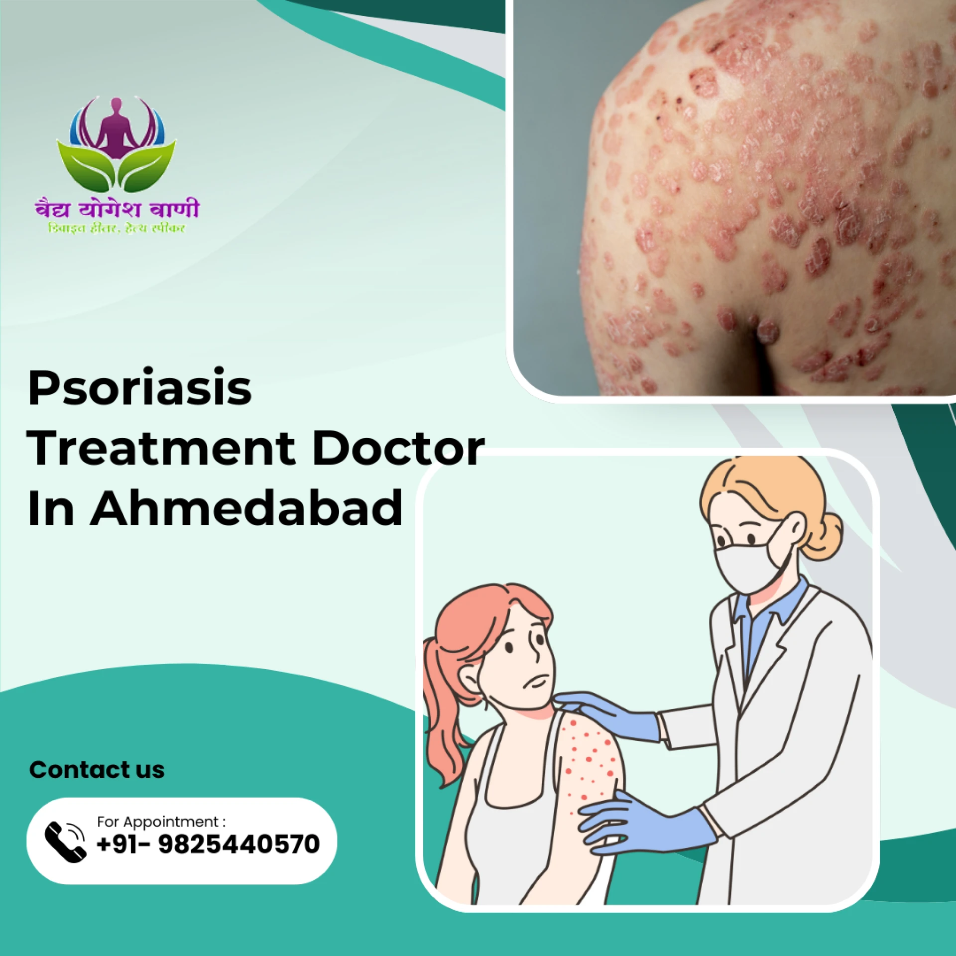 Best Psoriasis Treatment in Ahmedabad with Vaidya Yogesh Vani