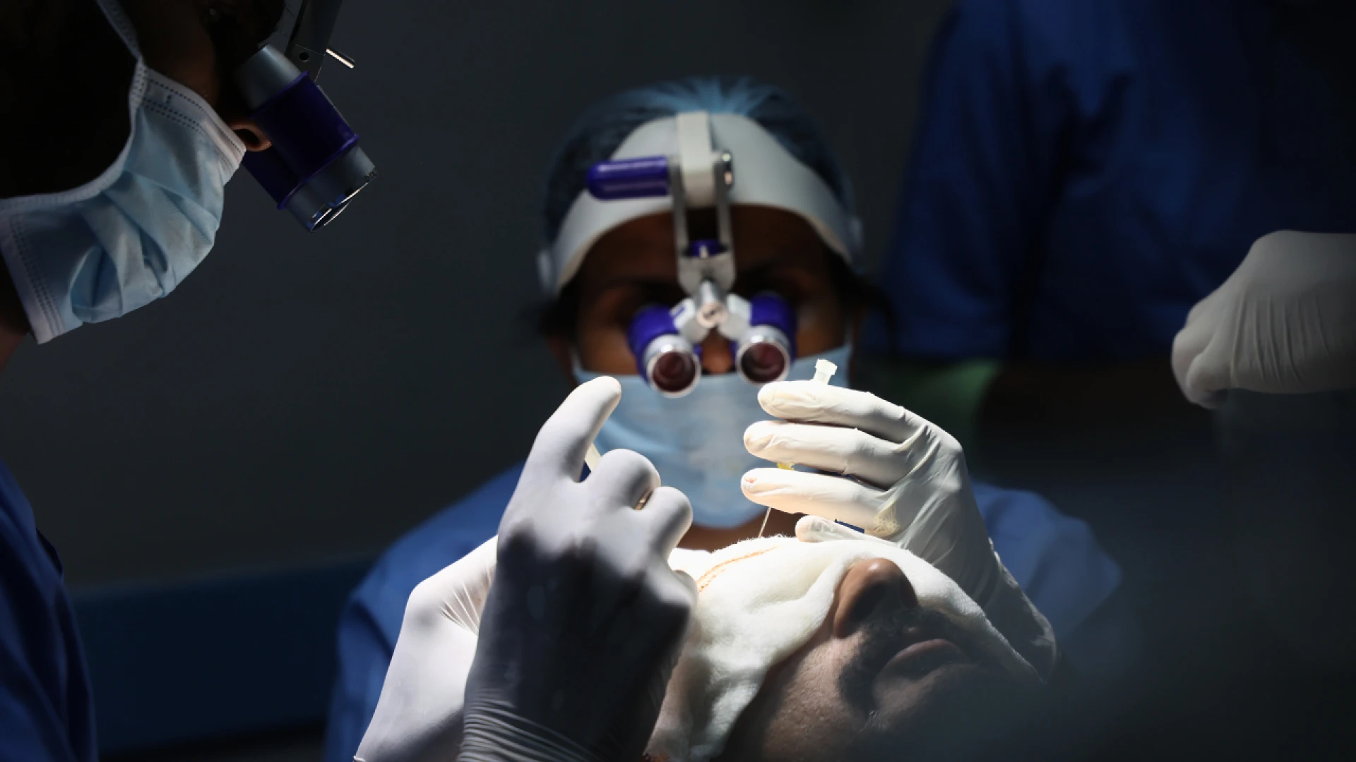 Unlock Your Best Hair: The Ultimate Guide to Hair Transplants in India